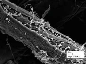 microscopic image of bacteria breaking down plant structural carbohydrates