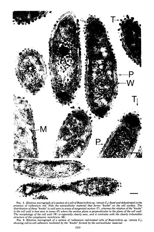 electron micrograph showing "knobs" on the cells surface of Butryribivrio fibrisolvens