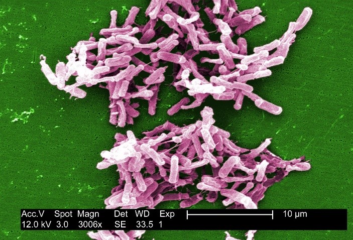 image of clostridium