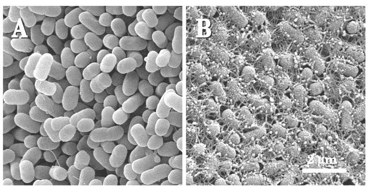 ​Certain strains of Escherichia coli