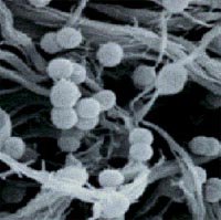 microscopic images of cellulolytic bacteria breaking down cellulose