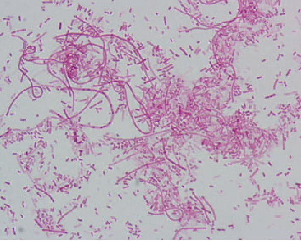 microscopic image of Gram stained bacteria