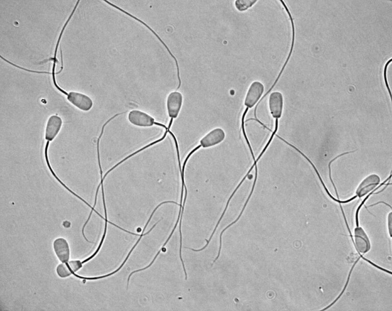 обнаружена днк ureaplasma spp что это