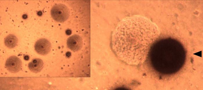images of ureaplasma