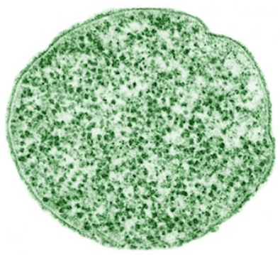 image of Ureaplasma urealyticum