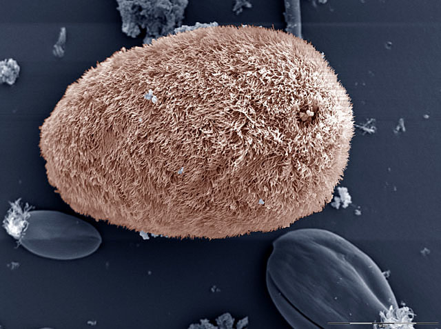 colored microscopic image of protozoa