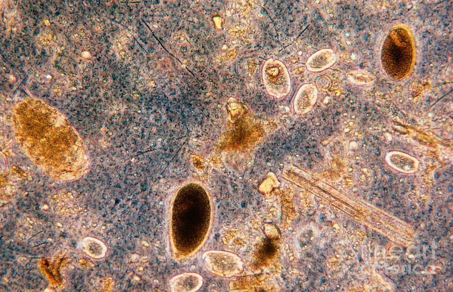 protozoa under a microscope