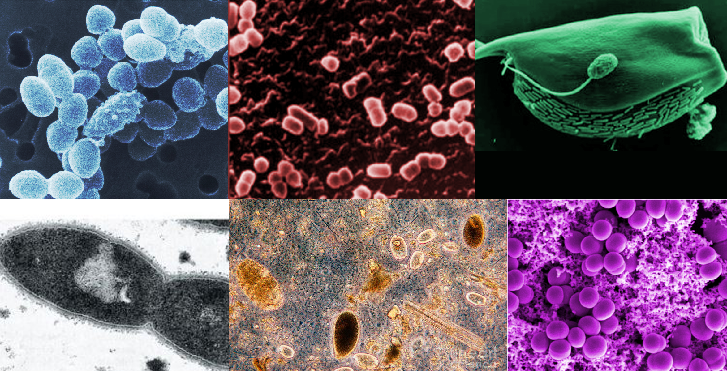 six microscopic images of various microbes