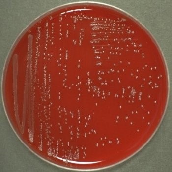 petri dish with bacterial colonies