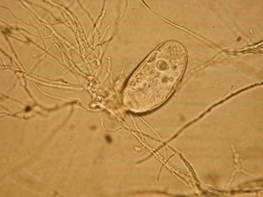 microscopic image of protozoa