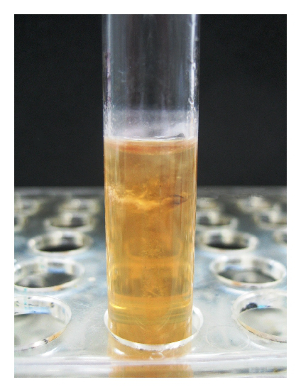 bacterial culture in a test tube