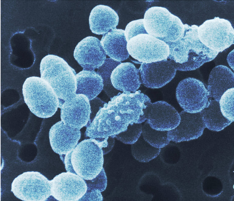 Rumen Microbes - Ruminococcus flavefaciens | Department of Animal Science