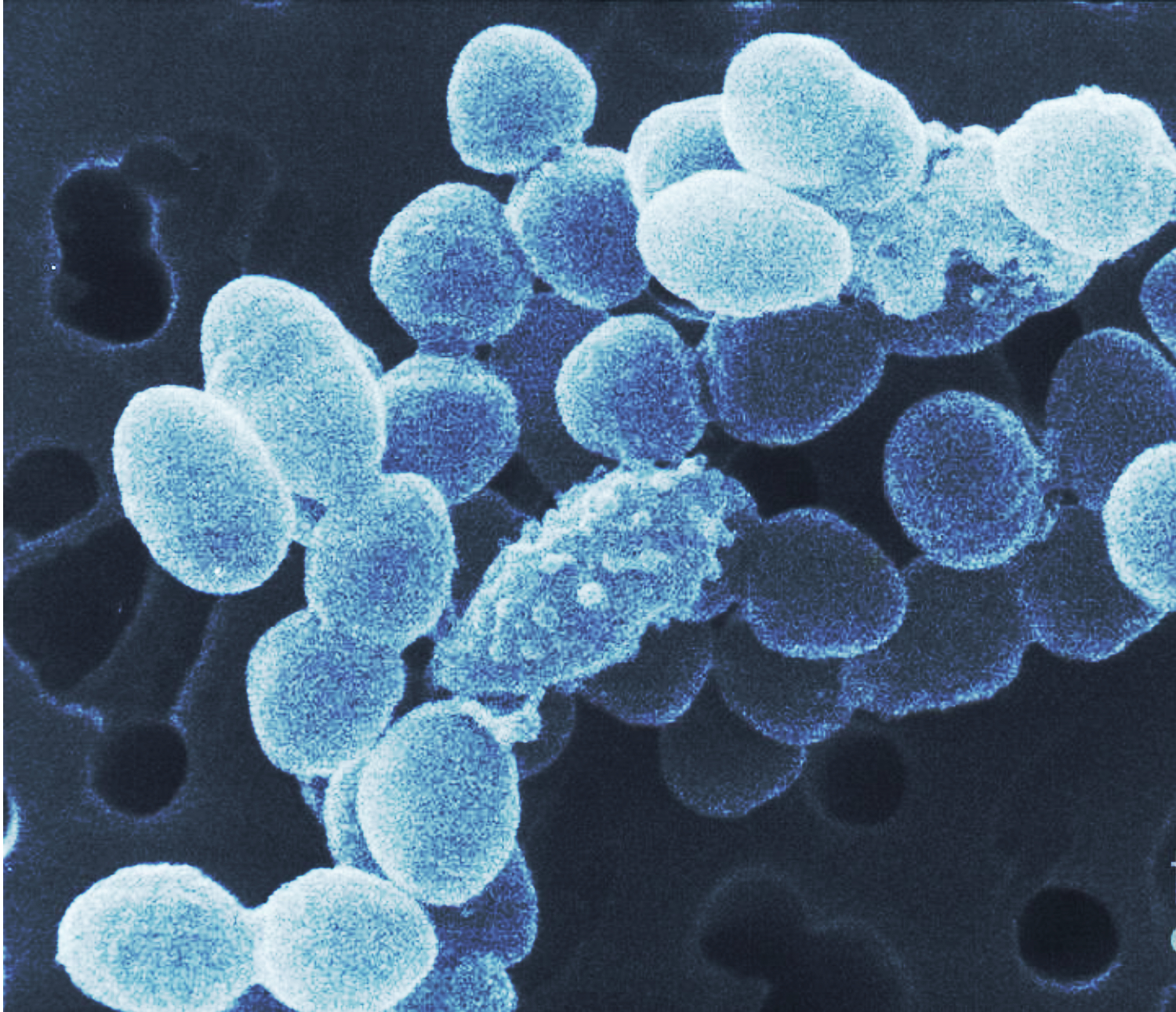 Ruminococcus flavefaciens | Department of Animal Science