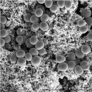 clusters of staph cells