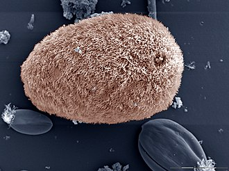 Microscopic image of Isotricha