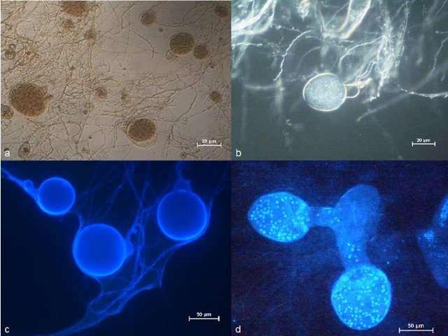 neocallimastix frontalis under microscope