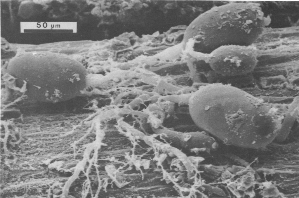 Anaerobic fungi on fiber in the rumen of cattle